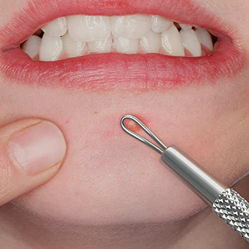 Suvorna White Head Remover for Face, Pimple Extractor, Pimple Popper, Whitehead Remover for Face, Comedone Extractor Tool, Pimple Extractor Tool, Pimple Popper Tool.