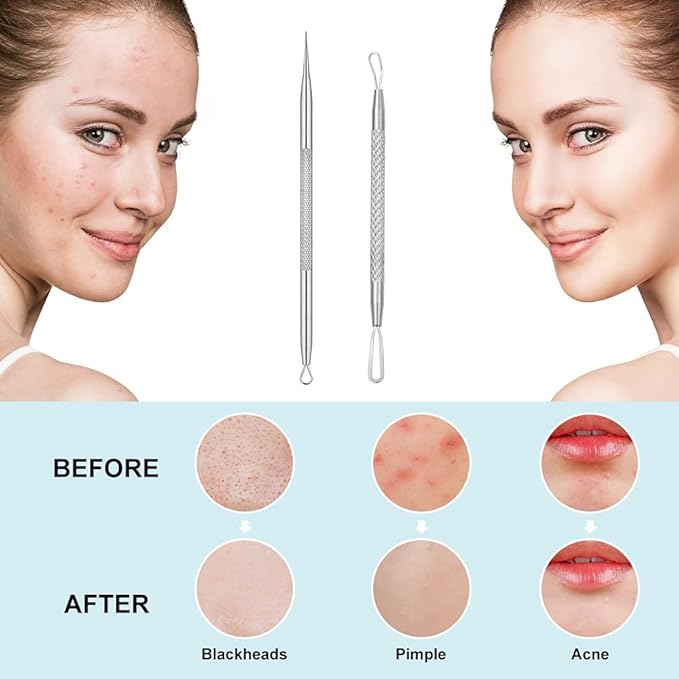 Professional Blackhead and Blemish Remover -Pimple Comedone Removal 2-in-1 Extractor Tool -by La Chat (2 Packs)