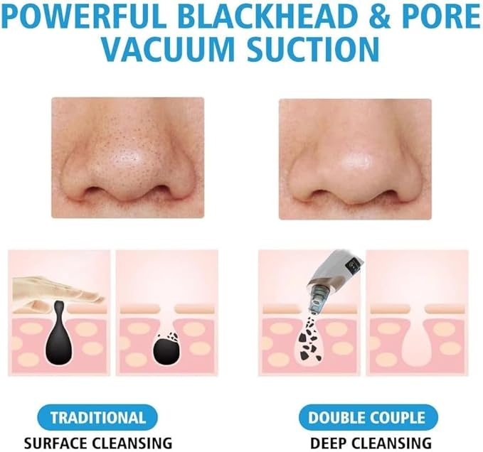 Blackhead Remover Vacuum - Professional Blackhead Extractor for Face with 3 Adjustable Suction Levels, USB Rechargeable Pore Cleaner, and 5 Interchangeable Probes (Off-White)