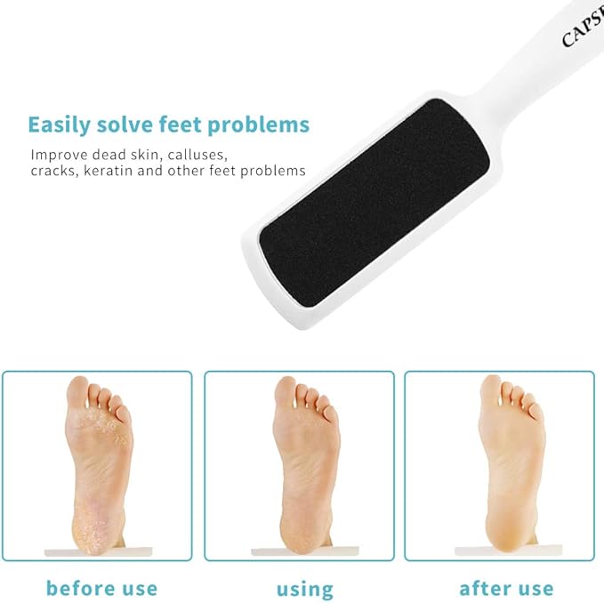 Pedicure Foot Rasp File Callus Remover, Double-Sided Colossal Foot Rasp Foot File And Callus Remover For Dead Skin (Pack of 4)