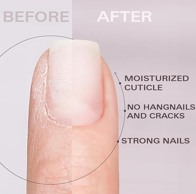 Nail Oil Cuticle Pen - Fragrance Free - Nail Strengthener & Growth Serum with Vitamin A, D, E, B5, Grapeseed & Natural Oils - Repair for Brittle, Peeling, Thin Nails - Gift Idea