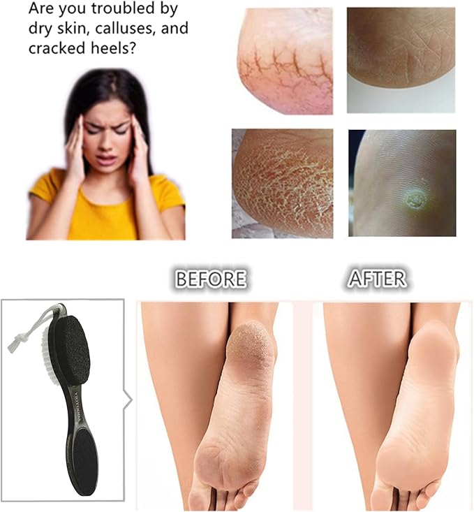 Foot File Callus Remover 4-in-1, 2 Pcs Feet Scraper Pedicure Tools with Pumice Stone, Scrubber Brush, Foot Rasp and Sand Paper, Double Sided Multi Purpose, Clear Black