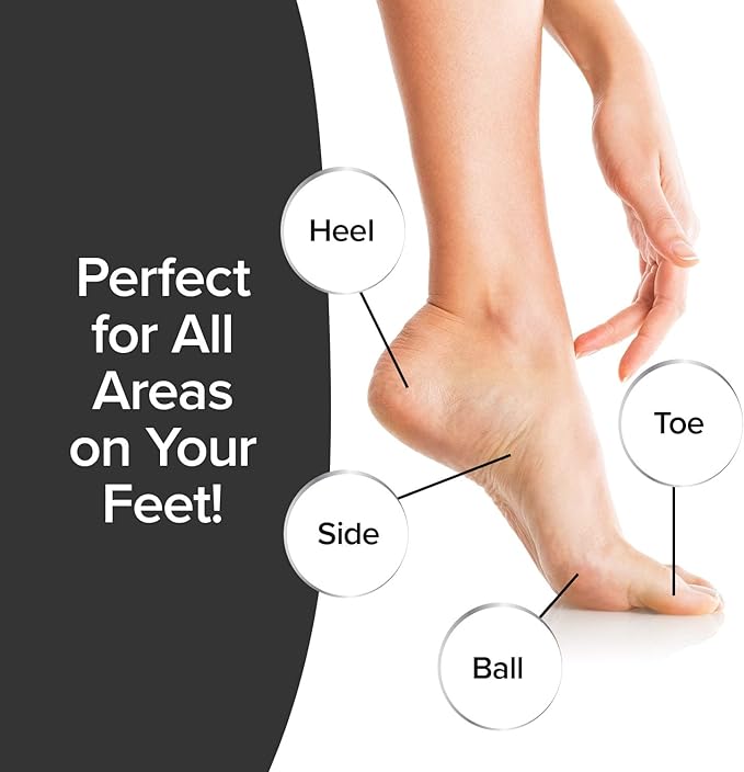 PedEgg Foot File – Traps Shavings Inside for Mess-Free Use – Painless Callus Remover with Ergonomic Handle for Tough, Dry Skin & Smooth, Soft Feet