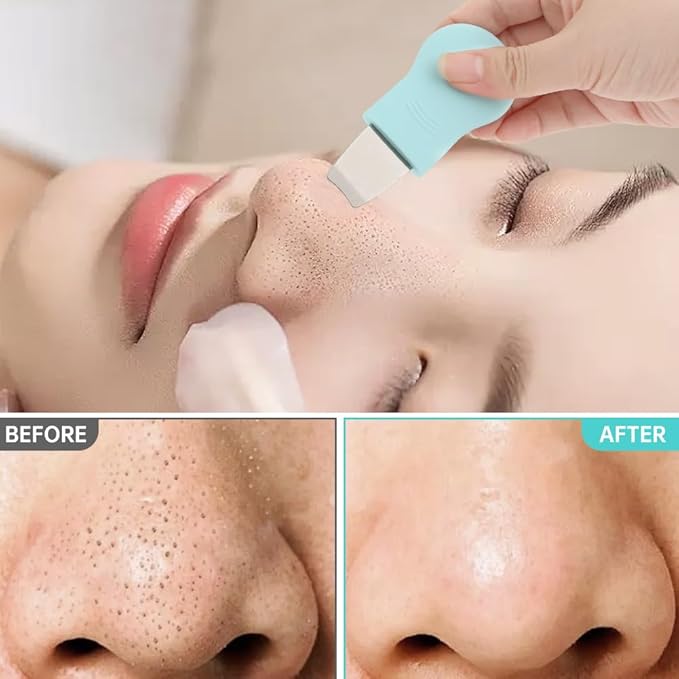 Blackhead Remover Tool Set,Silicone Blackhead Scraper,Face Scraper and Pore Cleaning Brush,Skin Scrubber Face Spatula for Deep Cleansing,Face Exfoliator Scrubber for Women Men