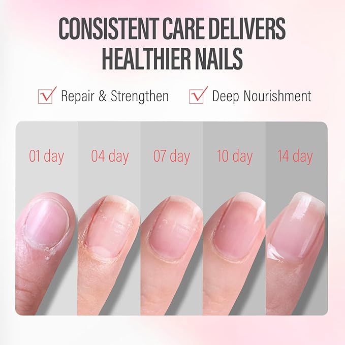 CHUCHU Nail Growth and Strengthener Oil for Cuticle - Rose Scent Cuticle Oil Repair Moisturizing Treatment - Natural Jojoba Vitamin B & E Nail Oil for Dry Cracked Nails
