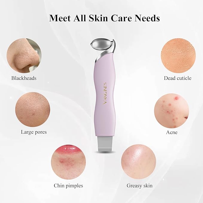 3-in-1 Blackhead Remover Tool with Ice Roller & 2 Silicone Brush Heads - Pore Cleaning Face Spatula, Stainless Steel Skin Scraper for Nose, T-Zone Deep Cleansing(Berry Mauve)