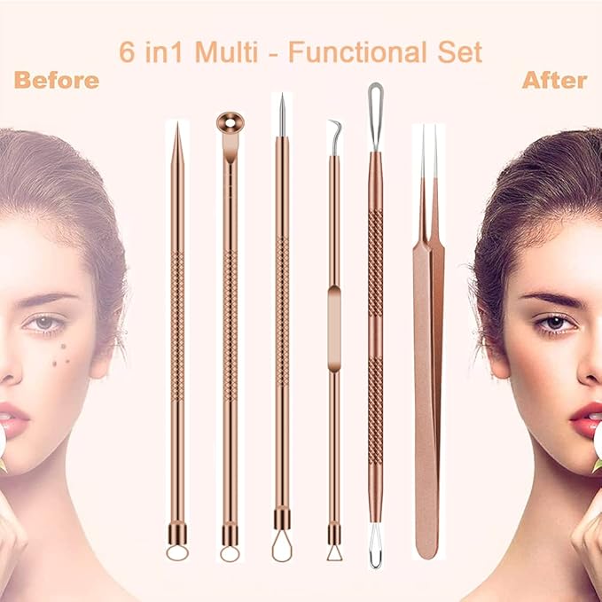 Pimple Popper Tool Kit, 6 Pcs Blackhead Remover Acne Needle Tools Set Removing Treatment Comedone Whitehead Popping Zit for Nose Face Skin Blemish Extractor Tool - Rose Gold