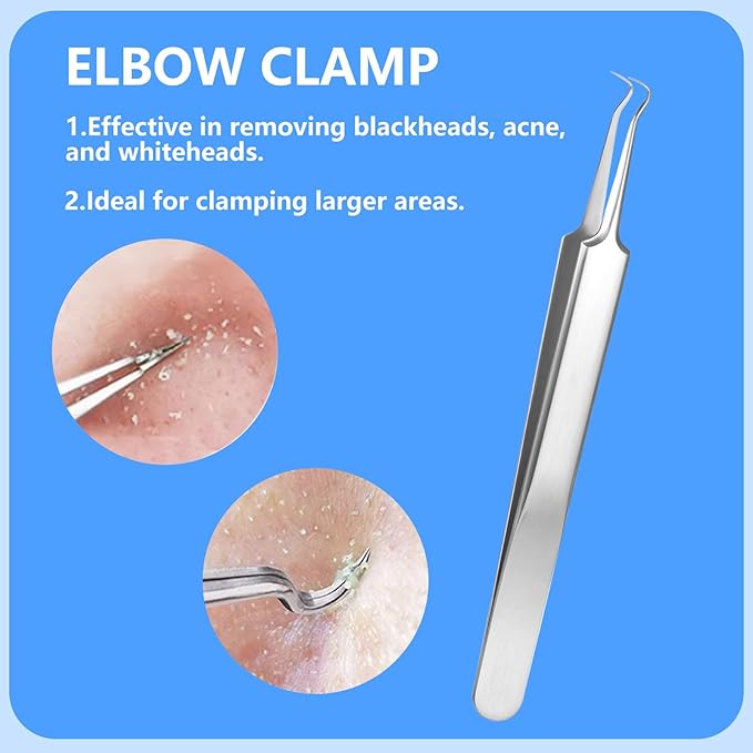 5PCS Blackhead Remover Comedone Extractor Kit - Professional Stainless Steel Tools for Pimple, Acne, and Blemish Removal - Curved Tweezers Included