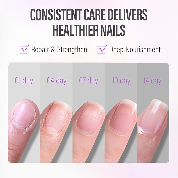 CHUCHU Nail Growth and Strengthener Oil for Cuticle - Blueberry Scent Cuticle Oil Repair Moisturizing Treatment - Natural Jojoba Vitamin B & E Nail Oil for Dry Cracked Nails