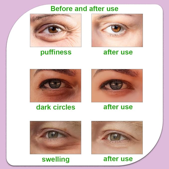 Hot and Cold Eye Pads, reusable eye patches - Soothing, Revitalizing, Puffiness, Refresh, Relieves Stress, Relax, Relieves Puffiness and Tension(2 watermelons + 2 cucumbers)