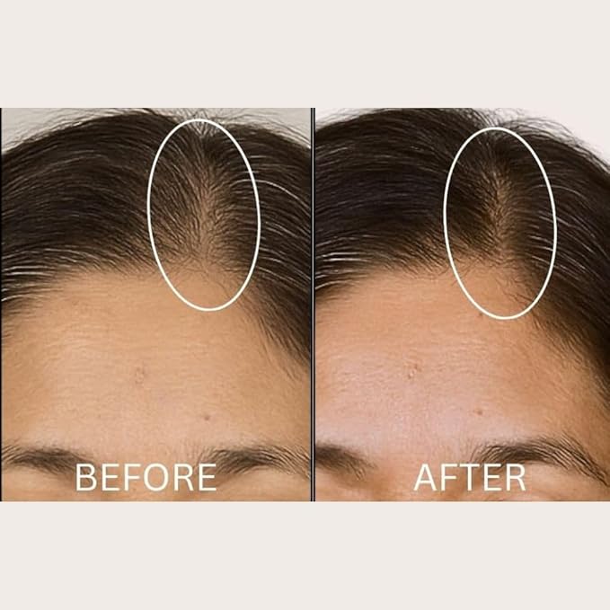 Solaris Laboratories NY Cloud Nine Hair Density and Boosting Stimulating Scalp Massager