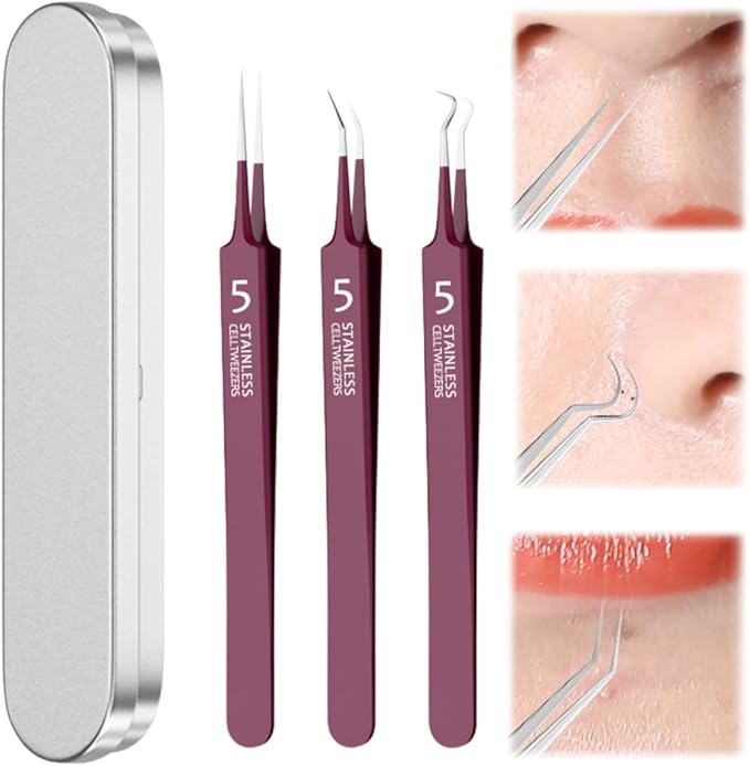 Usiveinborn Blackhead Remover Upgraded, Usiveinborn Blackhead Tweezers, Professional Upgraded Facial Blackhead Remover Tweezers, Blackhead Remover Tools Sets (A4-Red-3pcs)
