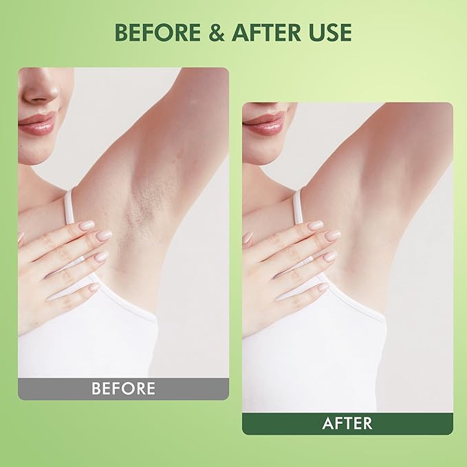 Armpit Detox and Scrub with Shea Butter and Coconut 8.82oz-Exfoliating Scrub with Natural Ingredients for Removing Odor, Deep Cleansing and Exfoliating, also for Legs, Knee, Feet, Hands, Body