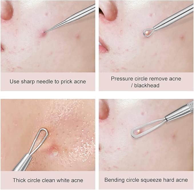 Professional Blackhead and Blemish Remover -Pimple Comedone Removal 2-in-1 Extractor Tool -by La Chat (2 Packs)