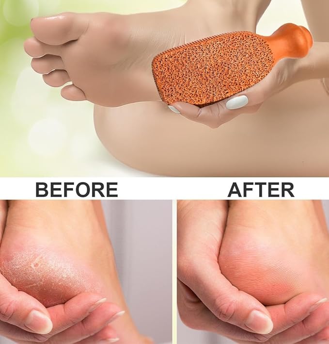 Pumice Stone for Feet - 2-Sided Terra Cotta Foot Scrubber, Professional Exfoliating Clay Stone for Feet Hands Body Care - Pumice Stone for Feet Callus Remover, Brown (Pack of 2)
