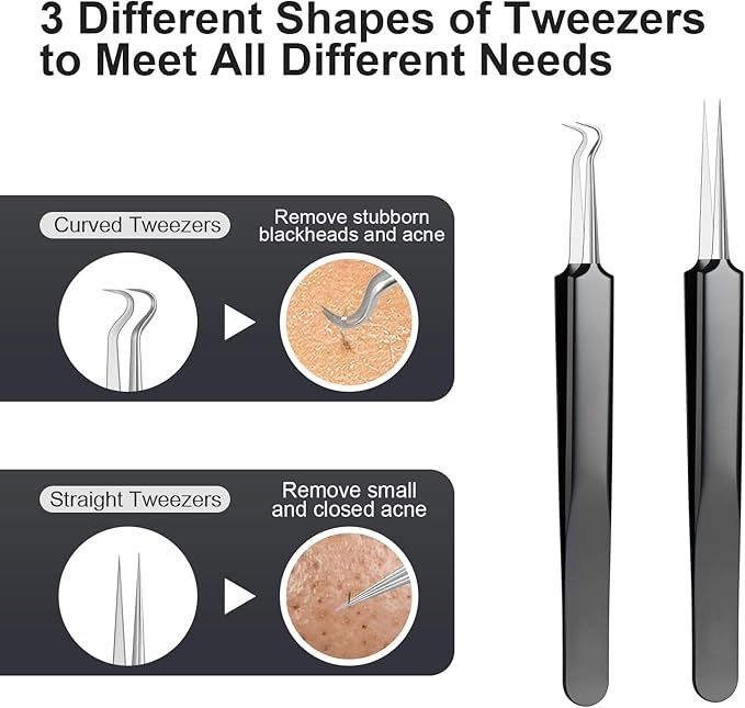 Pimple Popper Tool kit Blackhead Remover Comedone Extractor Kit with Box for Easily Remove blackheads, Acne, Blemishes, Whiteheads, pimples and Papules from the face and Bonus Gift -7pcs