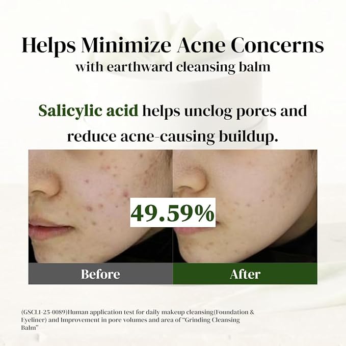 Cleansing Balm – 98.824% makeup removal with AHA BHA PHA, Salicylic Acid & Centella for Deep Makeup Removal, Pore Cleansing, Blackheads, Oil Control & Sensitive Skin Care (2pcs)