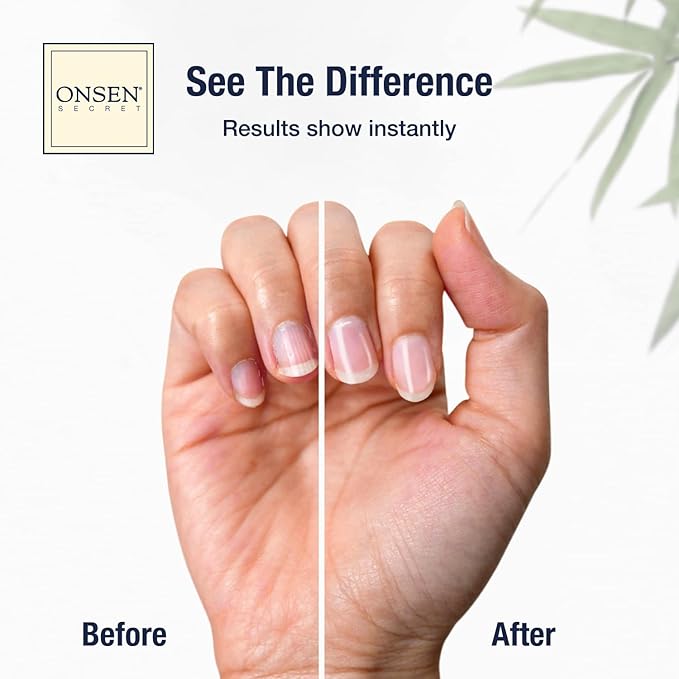 Onsen Japanese Nail File Buffer Sparkle-KIT 1.0, A Free 120/180 Grit Nail File,3-Way Buffer Block, Cuticle Serum with Cuticle Oil in Action-15ml, Optimum Care Series