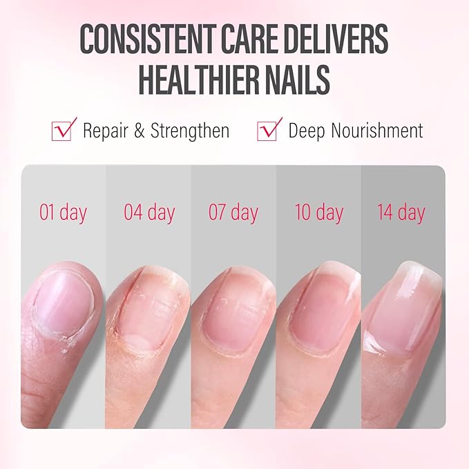 CHUCHU Nail Cuticle Oil Strengthener - Pomegranate Scent Repair Growth Moisturizing Treatment - Natural Jojoba Vitamin B & E for Dry Cracked Nails