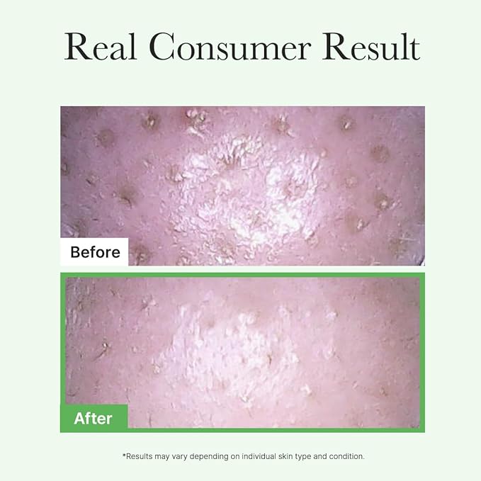 ARENCIA Pore Melt Mochi Makeup-Removing Cleansing Oil, Non-Comedogenic, Rice Amino Acids HD, Vitamin E, Cica, & Ceramide, 6.76 fl oz (Pack of 2)