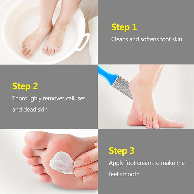 4 Pcs Pedicure Foot Files Callus Remover with Double Sided Feet Rasp for Dead Skin - Professional Foot Care Tools to Removes Hard Skin Corns for Dry and Wet Feet