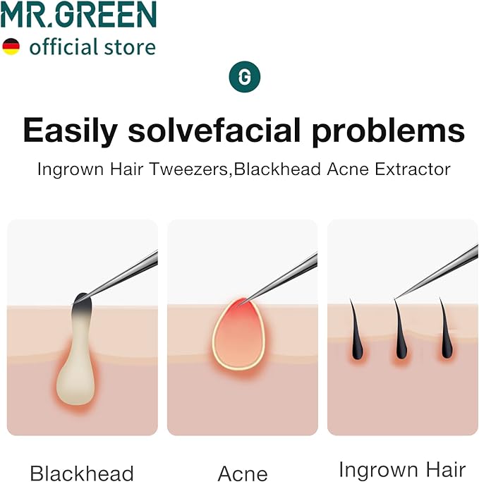 MR.GREEN Ingrown Hair Tweezers Needle Nose Pointed Tips Tweezers For Eyebrows Splinters Blackhead Removal Acne Clip Extractor (Short)
