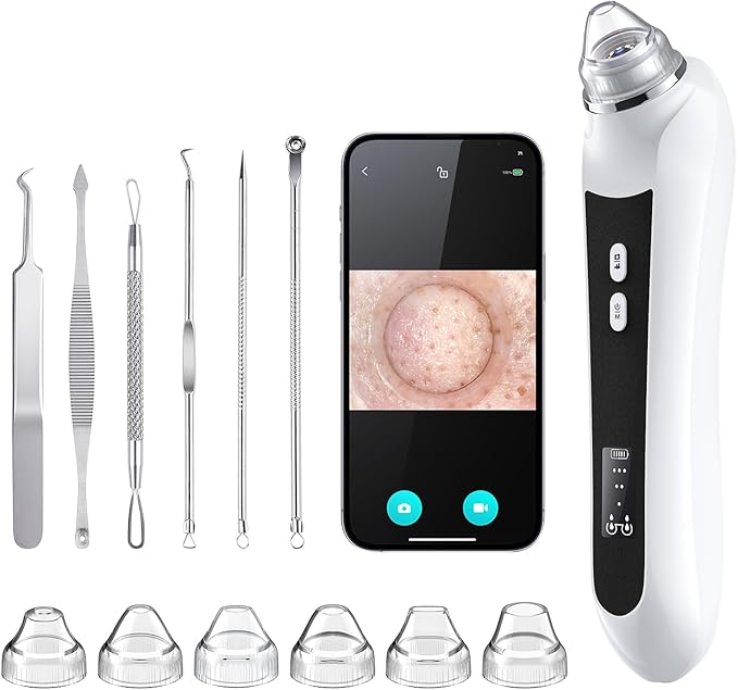 Blackhead Remover Vacuum, USB Interface Type Pore Vacuum, Black Head Extractions Tool with Camera for Men and Women Pore Cleaner, 3 Adjustment Modes & 6 Suction Heads(Black)