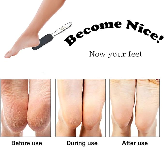 Professional Pedicure Foot File - Reusable Stainless Steel Cracked Skin Corns Callus Remover Feet Rasp