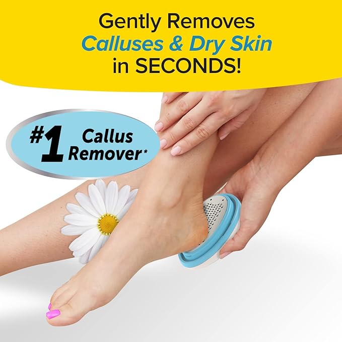 PedEgg Foot File – Traps Shavings Inside for Mess-Free Use – Painless Callus Remover with Ergonomic Handle for Tough, Dry Skin & Smooth, Soft Feet