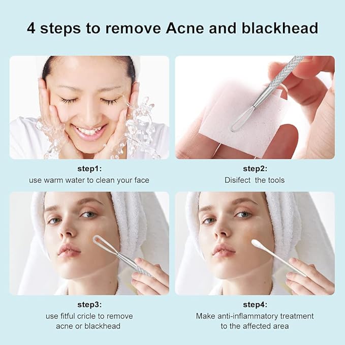 Professional Blackhead and Blemish Remover -Pimple Comedone Removal 2-in-1 Extractor Tool -by La Chat (Short)