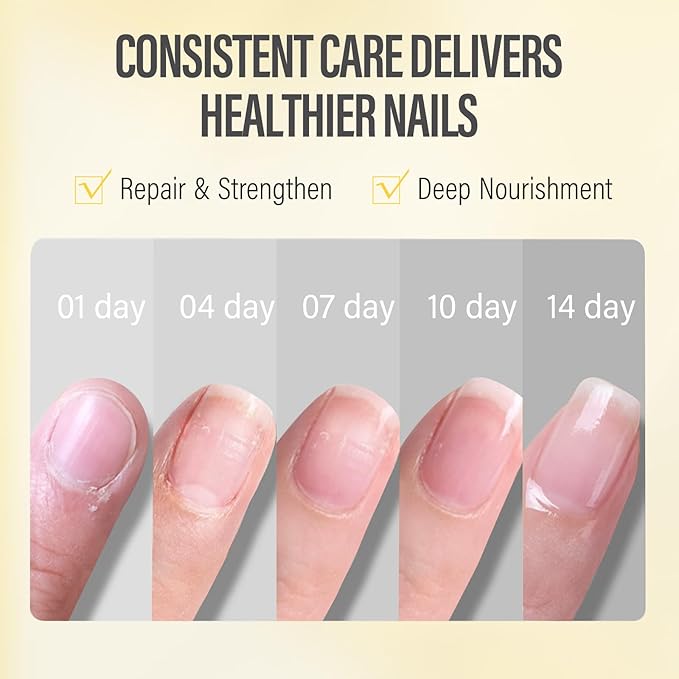 CHUCHU Nail Growth and Strengthener Oil for Cuticle - Pineapple Scent Cuticle Oil Repair Moisturizing Treatment - Natural Jojoba Vitamin B & E Nail Oil for Dry Cracked Nails