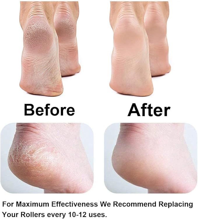 Replacement Roller Compatible with Dr. Scholl's Callus Remover Electronic Foot File-Extra Coarse (6 Pack)