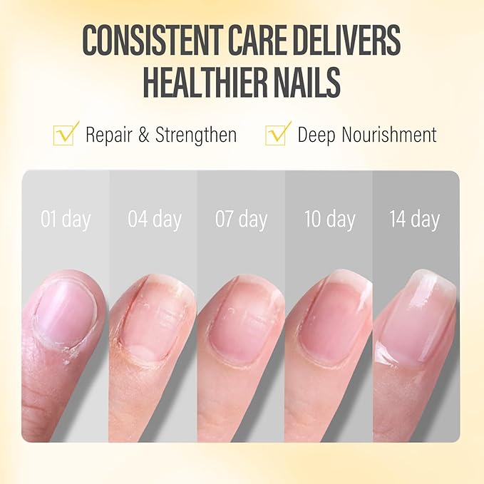 CHUCHU Nail Growth and Strengthener Oil for Cuticle - Orange Scent Cuticle Oil Repair Moisturizing Treatment - Natural Jojoba Vitamin B & E Nail Oil for Dry Cracked Nails