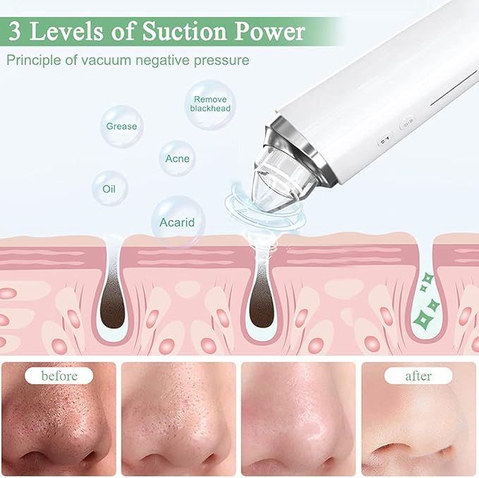 Blackhead Remover Pore Vacuum with 5MP HD Camera, 20X Magnification WiFi Visible Facial Pore Cleanser, FDA-Registered Electric Pimple Acne Comedone Extractor Kit for Men & Women with 6 Probes