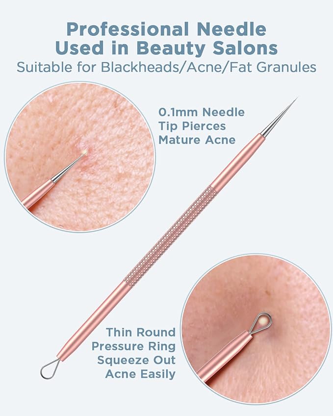 TAYTHI Blackhead Remover Tool, Pimple Popper Tool Kit, Blackhead Extractor Tool for Face, Extractor Tool for Comedone Zit Acne Whitehead Blemish, Stainless Steel Extraction Tools