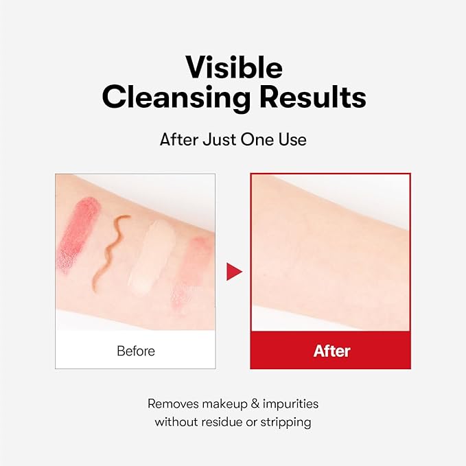 VT COSMETICS Azelaic Acid Cleansing Oil for Acne-Prone & Sensitive Skin, Lightweight Watery Texture Makeup Remover, Pore Cleansing Oil, Removes SPF & Sebum, Blackhead Care (200 ml / 6.76 fl oz)