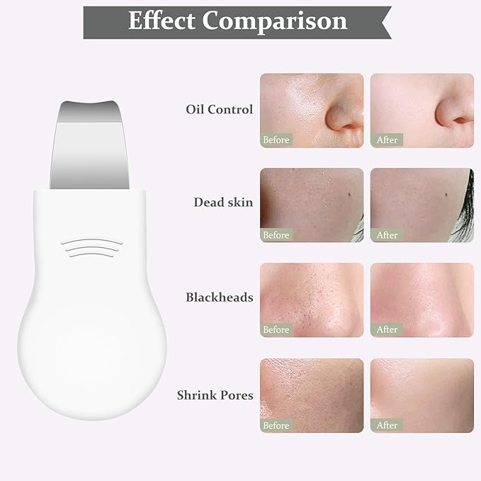 Blackhead Remover Tool,Silicone Face Scrubber, 2 in 1 Nose Pore Scraper for Deep Cleansing,Face Skin Spatula, Nose Black Head Remover, Pore Cleaner Skin Care Tool for Men Women Gifts