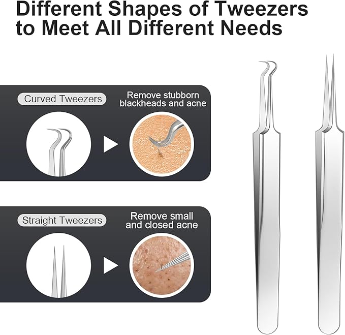 Pimple Popper Tool kit Blackhead Remover Comedone Extractor Kit with Box for Easily Remove blackheads, Acne, Blemishes, Whiteheads, pimples and Papules from the face and Bonus Gift -7pcs