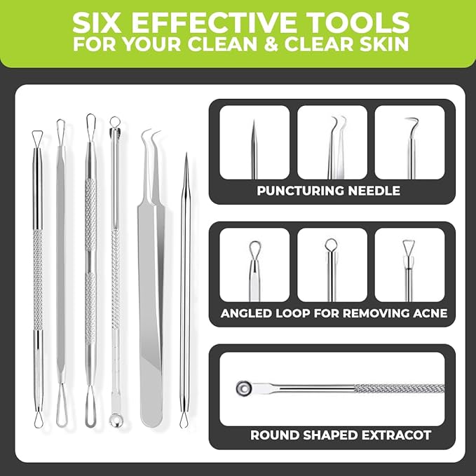 6 Pcs Blackhead Remover Tools 410 Grade Stainless Steel | Pimple Popper Tool Kit | Stainless Steel Professional Pimple Extractor Tool Kit for Blackheads, Comdone, Acne, Zit, and Whiteheads