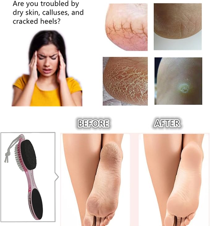 Foot File Callus Remover 4-in-1, 2 Pcs Feet Scraper Pedicure Tools with Pumice Stone, Scrubber Brush, Foot Rasp and Sand Paper, Double Sided Multi Purpose, Clear Pink