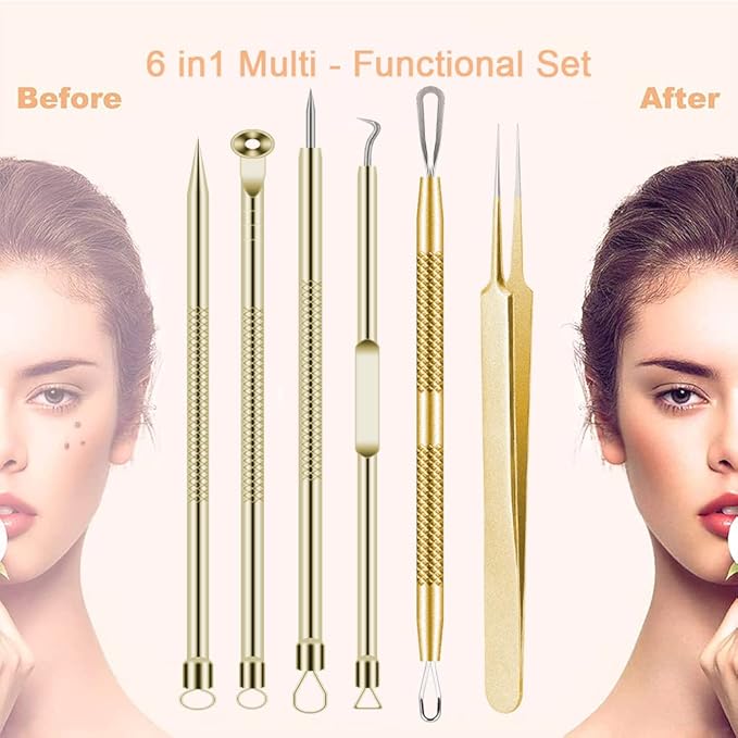Pimple Popper Tool Kit 6 Pcs Blackhead Remover Acne Needle Tools Set Removing Treatment Comedone Whitehead Popping Zit for Nose Face Skin Blemish Extractor Tool - Gold