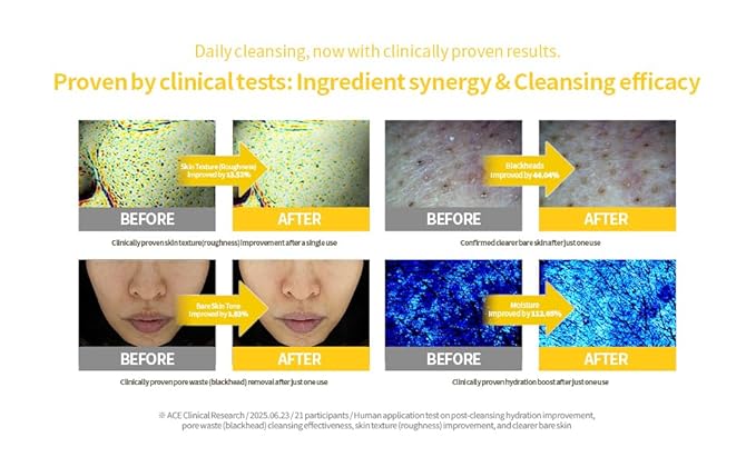 Secret Key Lemon Sparkling Cleansing Balm 5.07 fl. oz. (150ml), Makeup Remover, AHA BHA, Deep Cleansing, Korean Face Cleanser