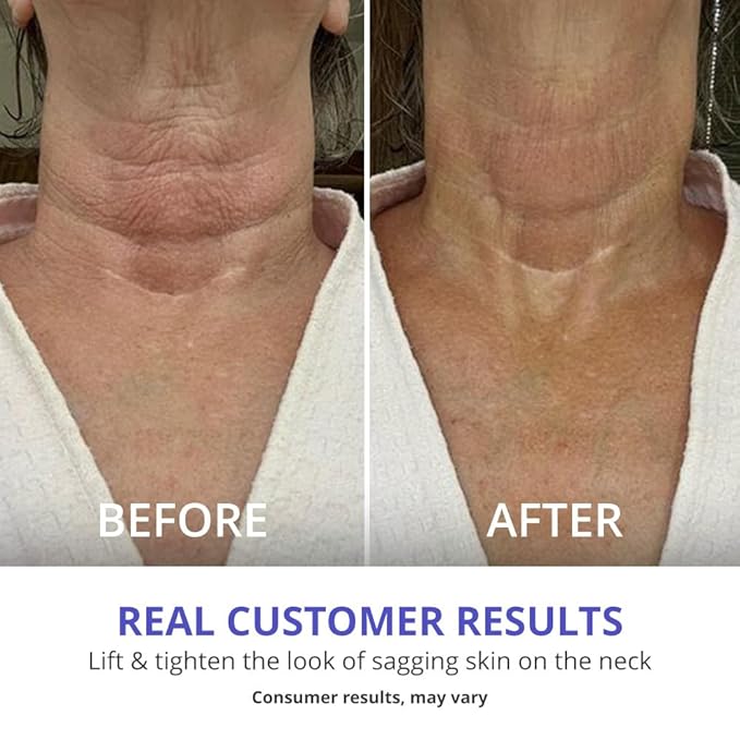 goPure Tighten & Lift Neck & Chest Moisturizer Cream for Visibly Firming, Tightening and Lifting Wrinkles & Crepey Skin, 1.7oz - Pack of 2