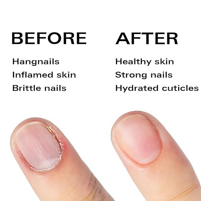 Nail Oil Cuticle Pen - Watermelon - Nail Strengthener & Growth Serum with Vitamin A, D, E, B5, Grapeseed & Natural Oils - Repair for Brittle, Peeling, Thin Nails - Gift Idea