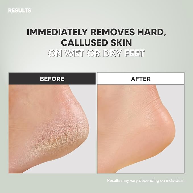 S-Line Emery Foot File, Colossal Double-Sided Pedicure Tool, Effective for Cracked Heel, Ergonomic Design for Easy Grip (Pattern)