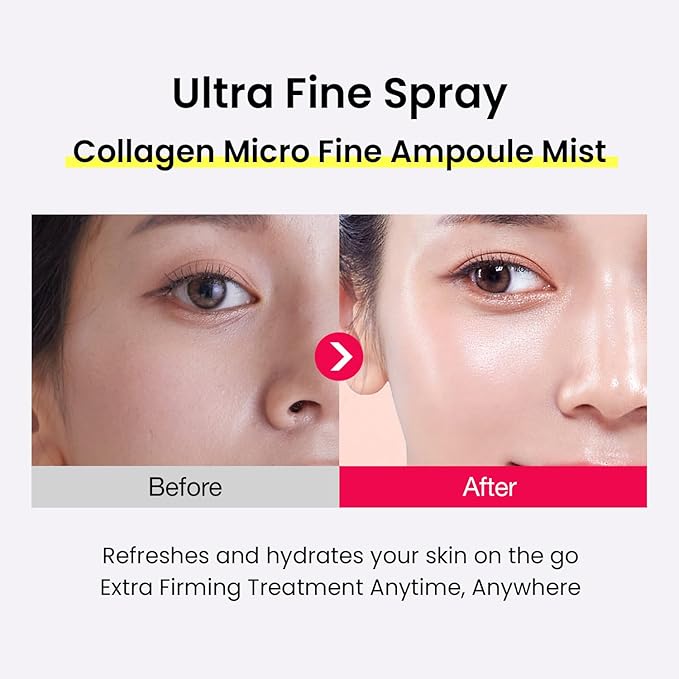 Ultra Collagen Ampoule Face Mist for Dewy & Radiant Skin – Hydrating Korean Skincare Spray with Niacinamide & Retinol, Lightweight Moisture Glow Mist, 2.70 fl.oz