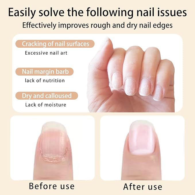 Nail Cuticle Oils Nutrition Oil Pen Nourishment Pens 2Pcs Jasmine Smell Cuticle Revitalizer for Agnail Nourish Skin Nail Care
