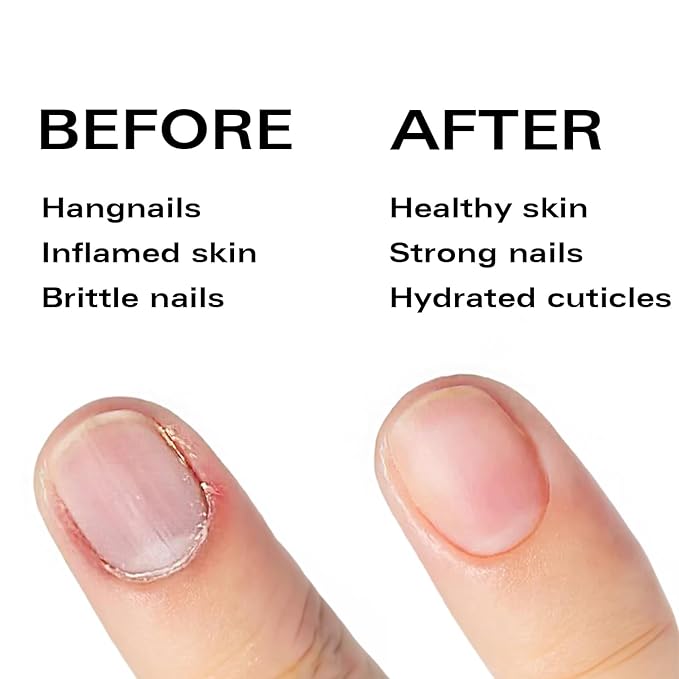 Nail Oil Cuticle Pen - Lemon - Nail Strengthener & Growth Serum with Vitamin A, D, E, B5, Grapeseed & Natural Oils - Repair for Brittle, Peeling, Thin Nails - Gift Idea