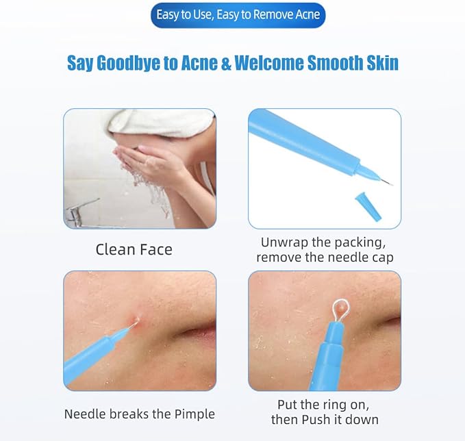 10 Pack of Disposable Sterile Acne Remover Tools Safe Pimple Popper Tool Aseptic Blackhead Remover Tools Sanitary Comedone Extractor Tool Pimple Extractor Tool