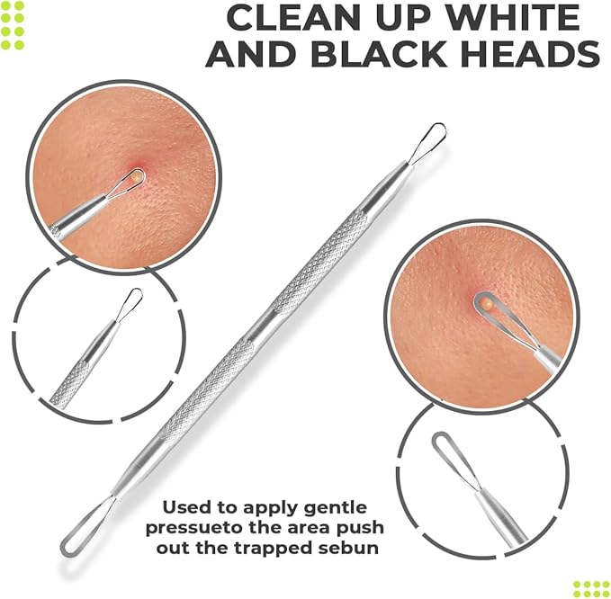 2 Pcs Pimple Extractor Tool 410 Grade Stainless Steel | Comedone Extractor, Pimple Popper, Blackhead Remover for Face, Zit Popper, Pimple Needle for Acne Removal